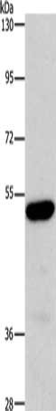 Gel: 6%SDS-PAGE, Lysate: 40 μg, Lane: Human fetal liver tissue, Primary antibody: ARSB Antibody(ARSB Antibody) at dilution 1/340, Secondary antibody: Goat anti rabbit IgG at 1/8000 dilution, Exposure time: 10 minutesRabbit anti-Human ARSB Polyclonal Antibody
