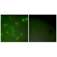Immunofluorescence analysis of COS7 cells, using Cyclin A antibody.