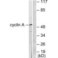 Western blot analysis of extracts from COS7 cells, using Cyclin A antibody.