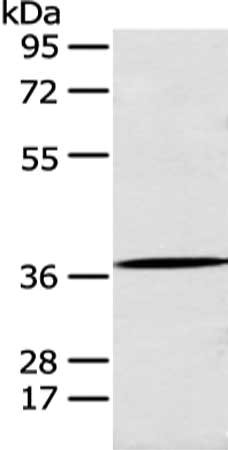 Gel: 8%SDS-PAGE, Lysate: 40 μg, Lane: A431 cell, Primary antibody: ANXA10 Antibody(ANXA10 Antibody) at dilution 1/200 dilution, Secondary antibody: Goat anti rabbit IgG at 1/8000 dilution, Exposure time: 5 secondsRabbit anti-Human ANXA10 Polyclonal Antibody