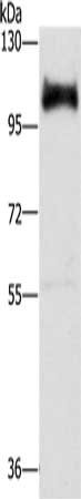 Gel: 6%SDS-PAGE, Lysate: 40 μg, Lane: Hela cells, Primary antibody: DAB2 Antibody(DAB2 Antibody) at dilution 1/350, Secondary antibody: Goat anti rabbit IgG at 1/8000 dilution, Exposure time: 1 secondRabbit anti-Human DAB2 Polyclonal Antibody