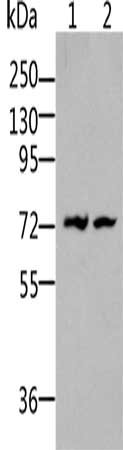 Gel: 10%SDS-PAGE, Lysate: 50 μg, Lane 1-2: Human leiomyosarcoma tissue, NIH/3T3 cells, Primary antibody: BDKRB2 Antibody(BDKRB2 Antibody) at dilution 1/500, Secondary antibody: Goat anti rabbit IgG at 1/8000 dilution, Exposure time: 1 minute
