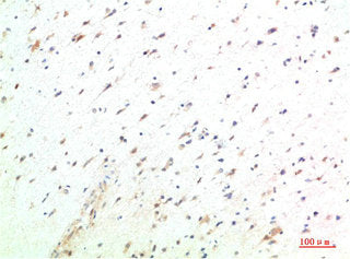 Immunohistochemical analysis of paraffin-embedded Human Testis Tissue using HSC70 Rabbit pAb diluted at 1:200Rabbit anti-Human HSPA8 Polyclonal Antibody