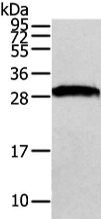 Gel: 8%SDS-PAGE, Lysate: 40 μg, Lane: NIH/3T3 cell, Primary antibody: VAPA Antibody(VAPA Antibody) at dilution 1/500 dilution, Secondary antibody: Goat anti rabbit IgG at 1/8000 dilution, Exposure time: 1 secondRabbit anti-Human VAPA Polyclonal Antibody