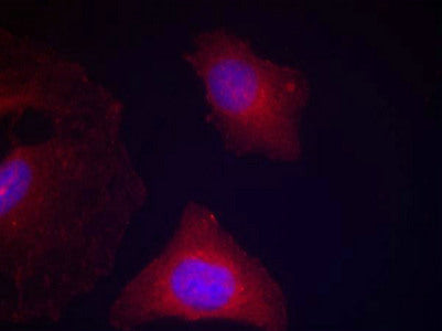 Immunofluorescence staining of methanol-fixed Hela cells using GSK3α/β(Phospho-Tyr279/216) Antibody.Rabbit anti-Human GSK3A/GSK3B Polyclonal Antibody