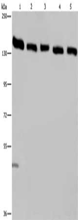 Gel: 6%SDS-PAGE, Lysate: 40 μg, Lane 1-5: Hela cells, human testis tissue, A549 cells, Jurkat cells, K562 cells, Primary antibody: IPO4 Antibody(IPO4 Antibody) at dilution 1/550, Secondary antibody: Goat anti rabbit IgG at 1/8000 dilution, Exposure time: 40 seconds