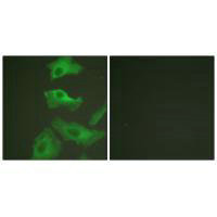 Immunofluorescence analysis of HeLa cells, treated with TNF-a (20nM, 15mins), using HSP90B (Ab-254) antibody.Rabbit anti-Human HSP90AB1 Polyclonal Antibody