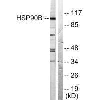 Western blot analysis of extracts from Hela cells treated with TNF-α (20ng/ml, 30min), using HSP90B (Ab-254) antibody.Rabbit anti-Human HSP90AB1 Polyclonal Antibody