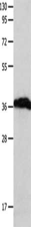 Gel: 10%SDS-PAGE, Lysate: 40 μg, Lane: Human brain malignant glioma tissue, Primary antibody: P2RY6 Antibody(P2RY6 Antibody) at dilution 1/550, Secondary antibody: Goat anti rabbit IgG at 1/8000 dilution, Exposure time: 1 minuteRabbit anti-Human P2RY6 Polyclonal Antibody