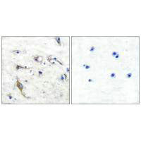 Immunohistochemical analysis of paraffin-embedded human brain tissue using JM4 antibody.Rabbit anti-Human PRAF2 Polyclonal Antibody