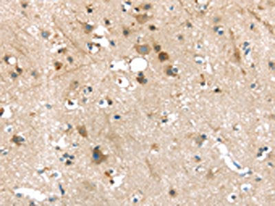 The image on the left is immunohistochemistry of paraffin-embedded Human brain tissue using P2RY2 Antibody(P2RY2 Antibody) at dilution 1/30, on the right is treated with synthetic peptide. (Original magnification: ×200)Rabbit anti-Human P2RY2 Polyclonal Antibody