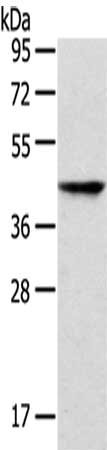 Gel: 8%SDS-PAGE,Lysate: 40 μg,,Primary antibody: P2RY2 Antibody(P2RY2 Antibody) at dilution 1/200 dilution,Secondary antibody: Goat anti rabbit IgG at 1/8000 dilution,Exposure time: 30 secondsRabbit anti-Human P2RY2 Polyclonal Antibody