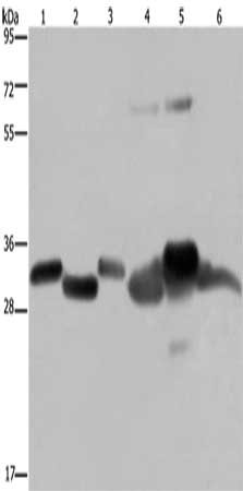 Gel: 8%SDS-PAGE, Lysate: 40 μg, Lane 1-6: Mouse thymus tissue, human ovarian cancer tissue, mouse heart tissue, human fetal liver tissue, mouse liver tissue, SKOV3 cells, Primary antibody: HMGCL Antibody(HMGCL Antibody) at dilution 1/300, Secondary antibody: Goat anti rabbit IgG at 1/8000 dilution, Exposure time: 5 secondsRabbit anti-Human HMGCL Polyclonal Antibody