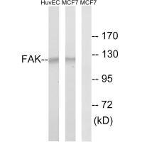 Western blot analysis of extracts from HUVEC cells and MCF-7 cells, using FAK (Ab-843) antibody.Rabbit anti-Human PTK2 Polyclonal Antibody