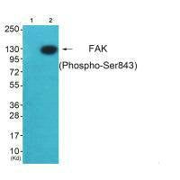Western blot analysis of extracts from HeLa cells (Lane 2), using FAK (Ab-843) antiobdy. The lane on the left is treated with synthesized peptide.Rabbit anti-Human PTK2 Polyclonal Antibody