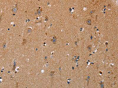 The image on the left is immunohistochemistry of paraffin-embedded Human brain  tissue using NRG3 Antibody(NRG3 Antibody) at dilution 1/30, on the right is treated with synthetic peptide. (Original magnification: ×200)Rabbit anti-Human NRG3 Polyclonal Antibody