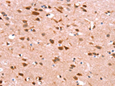 The image on the left is immunohistochemistry of paraffin-embedded Human brain tissue using the antibody Antibody) at dilution 1/40, on the right is treated with synthetic peptide. (Original magnification: ×200)Rabbit anti-Human GH1 Polyclonal Antibody