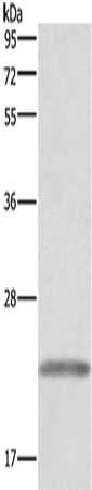 Gel: 10%SDS-PAGE, Lysate: 40 μg, Lane: Human placenta tissue, Primary antibody: GH1 Antibody(GH1 Antibody) at dilution 1/500, Secondary antibody: Goat anti rabbit IgG at 1/8000 dilution, Exposure time: 1 secondRabbit anti-Human GH1 Polyclonal Antibody