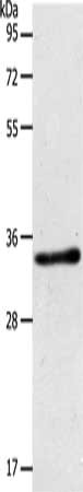 Gel: 10%SDS-PAGE, Lysate: 40 μg, Lane: Mouse kidney tissue, Primary antibody: ACY3 Antibody(ACY3 Antibody) at dilution 1/500, Secondary antibody: Goat anti rabbit IgG at 1/8000 dilution, Exposure time: 5 secondsRabbit anti-Human ACY3 Polyclonal Antibody