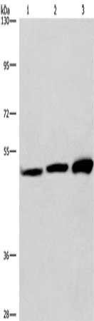 Gel: 6%SDS-PAGE, Lysate: 40 μg, Lane 1-3: Human Adrenal pheochromocytoma tissue, Jurkat cells, A549 cells, Primary antibody: VWA5A Antibody(VWA5A Antibody) at dilution 1/275, Secondary antibody: Goat anti rabbit IgG at 1/8000 dilution, Exposure time: 10 secondsRabbit anti-Human VWA5A Polyclonal Antibody