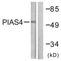 Western blot analysis of extracts from Jurkat cells, using PIAS4 antibody.Rabbit anti-Human PIAS4 Polyclonal Antibody
