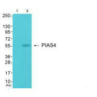 Western blot analysis of extracts from JK cells (Lane 2), using PIAS4 antiobdy. The lane on the left is treated with synthesized peptide.Rabbit anti-Human PIAS4 Polyclonal Antibody