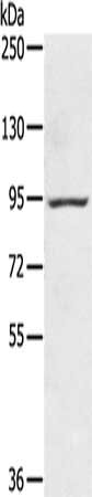 Gel: 6%SDS-PAGE, Lysate: 40 μg, Lane: Mouse brain tissue, Primary antibody: AXIN2 Antibody(AXIN2 Antibody) at dilution 1/200, Secondary antibody: Goat anti rabbit IgG at 1/8000 dilution, Exposure time: 30 secondsRabbit anti-Human AXIN2 Polyclonal Antibody