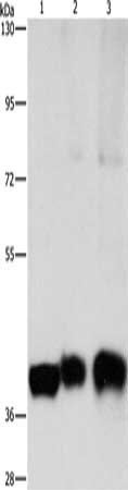 Gel: 8%SDS-PAGE, Lysate: 40 μg, Lane 1-3: Human lung cancer tissue, human fetal brain tissue, Human fetal lung tissue, Primary antibody: ASAH1 Antibody(ASAH1 Antibody) at dilution 1/850, Secondary antibody: Goat anti rabbit IgG at 1/8000 dilution, Exposure time: 30 secondsRabbit anti-Human ASAH1 Polyclonal Antibody
