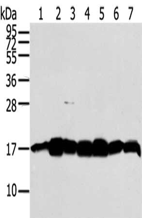 Gel: 12%SDS-PAGE,Lysate: 40 μg,Lane 1-7: Jurkat cells, A549 cells, Mouse brain tissue, 293T cells, LNCap cells, NIH/3T3 cells, Hela cells,Primary antibody: NME2 Antibody(NME2 Antibody) at dilution 1/300 dilution,Secondary antibody: Goat anti rabbit IgG at 1/8000 dilution,Exposure time: 30 secondsRabbit anti-Human NME2 Polyclonal Antibody