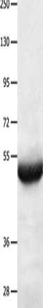Gel: 8%SDS-PAGE, Lysate: 40 μg, Lane: Human lung cancer tissue, Primary antibody: BPIFB3 Antibody(BPIFB3 Antibody) at dilution 1/550, Secondary antibody: Goat anti rabbit IgG at 1/8000 dilution, Exposure time: 30 seconds