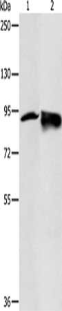 Gel: 10%SDS-PAGE, Lysate: 50 μg, Lane 1-2: Hela cells, 231 cells, Primary antibody: RRM1 Antibody(RRM1 Antibody) at dilution 1/200, Secondary antibody: Goat anti rabbit IgG at 1/8000 dilution, Exposure time: 1 minuteRabbit anti-Human RRM1 Polyclonal Antibody