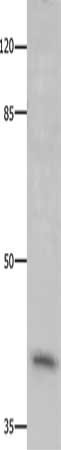 Gel: 8%SDS-PAGE, Lysate: 40 μg, Lane: HT29 cells, Primary antibody: CDK20 Antibody(CDK20 Antibody) at dilution 1/300, Secondary antibody: Goat anti rabbit IgG at 1/8000 dilution, Exposure time: 5 minutesRabbit anti-Human CDK20 Polyclonal Antibody