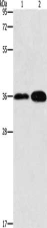 Gel: 12%SDS-PAGE, Lysate: 40 μg, Lane 1-2: Human fetal kidney tissue, Human liver cancer tissue, Primary antibody: ANXA9 Antibody(ANXA9 Antibody) at dilution 1/200, Secondary antibody: Goat anti rabbit IgG at 1/8000 dilution, Exposure time: 1 minuteRabbit anti-Human ANXA9 Polyclonal Antibody