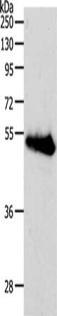 Gel: 10%SDS-PAGE, Lysate: 40 μg, Lane: Human liver cancer tissue, Primary antibody: RBMS3 Antibody(RBMS3 Antibody) at dilution 1/500, Secondary antibody: Goat anti rabbit IgG at 1/8000 dilution, Exposure time: 20 secondsRabbit anti-Human RBMS3 Polyclonal Antibody