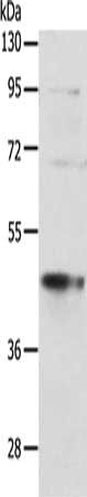 Gel: 10%SDS-PAGE, Lysate: 40 μg, Lane: MCF7 cells, Primary antibody: SPATA2L Antibody(SPATA2L Antibody) at dilution 1/500, Secondary antibody: Goat anti rabbit IgG at 1/8000 dilution, Exposure time: 40 secondsRabbit anti-Human SPATA2L Polyclonal Antibody