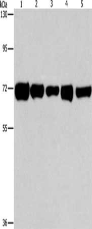 Gel: 8%SDS-PAGE, Lysate: 40 μg, Lane 1-5: Hela cells, A549 cells, MCF7 cells, human liver cancer tissue, Human lung cancer tissue, Primary antibody: RPN1 Antibody(RPN1 Antibody) at dilution 1/550, Secondary antibody: Goat anti rabbit IgG at 1/8000 dilution, Exposure time: 1 minuteRabbit anti-Human RPN1 Polyclonal Antibody
