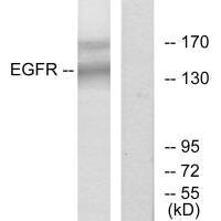 Western blot analysis of extracts from HT-29 cells, using EGFR (Ab-1172) antibody.Rabbit anti-Human EGFR Polyclonal Antibody