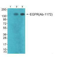 Western blot analysis of extracts from A549 cells (Lane 2) and HepG2 cells (Lane 3), using EGFR (Ab-1172) antiobdy. The lane on the left is treated with synthesized peptide.Rabbit anti-Human EGFR Polyclonal Antibody