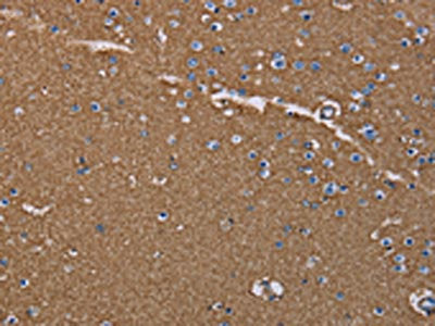 The image on the left is immunohistochemistry of paraffin-embedded Human brain  tissue using AQP4 Antibody(AQP4 Antibody) at dilution 1/20, on the right is treated with synthetic peptide. (Original magnification: ×200)Rabbit anti-Human AQP4 Polyclonal Antibody