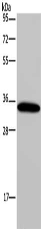 Gel: 10%SDS-PAGE, Lysate: 40 μg, Lane: Mouse heart tissue, Primary antibody: AQP4 Antibody(AQP4 Antibody) at dilution 1/200, Secondary antibody: Goat anti rabbit IgG at 1/8000 dilution, Exposure time: 1 minuteRabbit anti-Human AQP4 Polyclonal Antibody