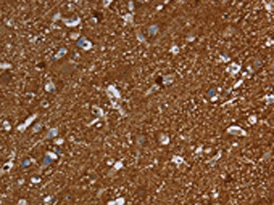 The image is immunohistochemistry of paraffin-embedded Human brain tissue using the antibody Antibody) at dilution 1/60. (Original magnification: ×200)Rabbit anti-Human SNCG Polyclonal Antibody
