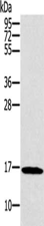 Gel: 12%SDS-PAGE, Lysate: 40 μg, Lane: HT29 cells, Primary antibody: SNCG Antibody(SNCG Antibody) at dilution 1/800, Secondary antibody: Goat anti rabbit IgG at 1/8000 dilution, Exposure time: 20 secondsRabbit anti-Human SNCG Polyclonal Antibody
