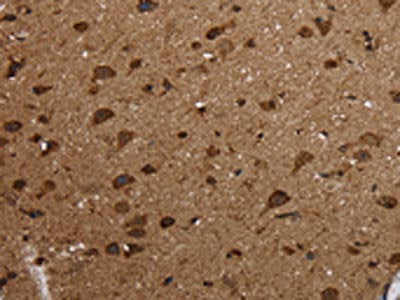 The image on the left is immunohistochemistry of paraffin-embedded Human brain  tissue using HSD17B13 Antibody(HSD17B13 Antibody) at dilution 1/30, on the right is treated with fusion protein. (Original magnification: ×200)Rabbit anti-Human HSD17B13 Polyclonal Antibody
