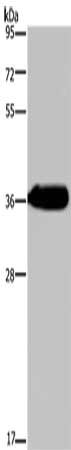 Gel: 10%SDS-PAGE, Lysate: 40 μg, Lane: Human fetal liver tissue, Primary antibody: HSD17B13 Antibody(HSD17B13 Antibody) at dilution 1/350, Secondary antibody: Goat anti rabbit IgG at 1/8000 dilution, Exposure time: 3 minutesRabbit anti-Human HSD17B13 Polyclonal Antibody