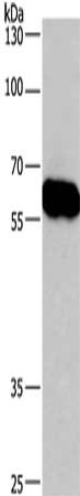 Gel: 8%SDS-PAGE, Lysate: 40 μg, Lane: Lovo cells, Primary antibody: CORO1C Antibody(CORO1C Antibody) at dilution 1/670, Secondary antibody: Goat anti rabbit IgG at 1/8000 dilution, Exposure time: 40 secondsRabbit anti-Human CORO1C Polyclonal Antibody