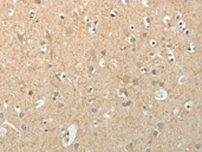 The image on the left is immunohistochemistry of paraffin-embedded Human brain tissue using TEKT5 Antibody(TEKT5 Antibody) at dilution 1/20, on the right is treated with fusion protein. (Original magnification: ×200)Rabbit anti-Human TEKT5 Polyclonal Antibody