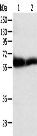 Gel: 10%SDS-PAGE, Lysate: 40 μg, Lane 1-2: Human brain malignant glioma tissue, human seminoma tissue, Primary antibody: TEKT5 Antibody(TEKT5 Antibody) at dilution 1/350, Secondary antibody: Goat anti rabbit IgG at 1/8000 dilution, Exposure time: 10 minutesRabbit anti-Human TEKT5 Polyclonal Antibody