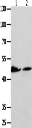 Gel: 10%SDS-PAGE, Lysate: 40 μg, Lane 1-2: Hela cells, 293T cells, Primary antibody: P2RY11 Antibody(P2RY11 Antibody) at dilution 1/500, Secondary antibody: Goat anti rabbit IgG at 1/8000 dilution, Exposure time: 1 minuteRabbit anti-Human P2RY11 Polyclonal Antibody