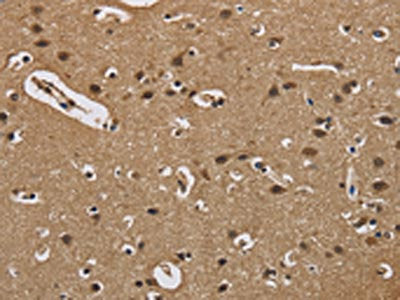 The image on the left is immunohistochemistry of paraffin-embedded Human brain  tissue using FABP2 Antibody(FABP2 Antibody) at dilution 1/40, on the right is treated with synthetic peptide. (Original magnification: ×200)Rabbit anti-Human FABP2 Polyclonal Antibody