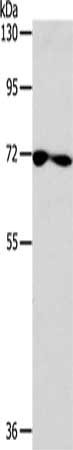 Gel: 8%SDS-PAGE, Lysate: 40 μg, Lane: Hela cells, Primary antibody: SPATA13 Antibody(SPATA13 Antibody) at dilution 1/400, Secondary antibody: Goat anti rabbit IgG at 1/8000 dilution, Exposure time: 2 minutesRabbit anti-Human SPATA13 Polyclonal Antibody